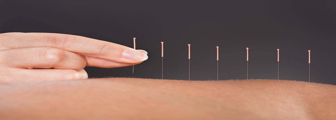 Can Acupuncture Help Treat Drug Addiction?